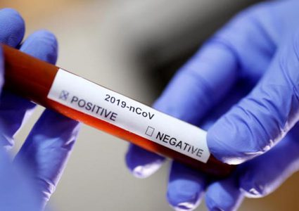 مصر تسجل 170 إصابة جديدة بفيروس كورونا