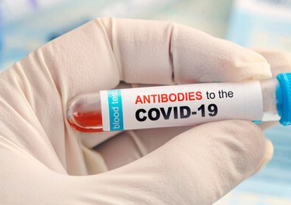 هل تتحول الأجسام المضادة إلى أداة مساعدة لفيروس كورونا ؟
