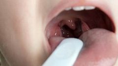 طرق علاج التهاب الحلق في الشتاء