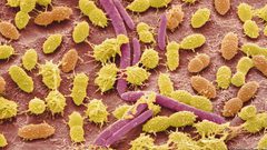 هل تحمي بكتيريا الأمعاء من أضرار الإشعاع ؟