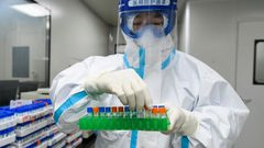 ما هو العضو الذي يعجز كورونا عن الوصول إليه ؟