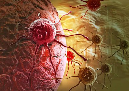 ما علاقة سرطان البنكرياس بداء السكري ؟