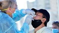 تساقط الأسنان.. عارض جديد لفيروس كورونا المستجد