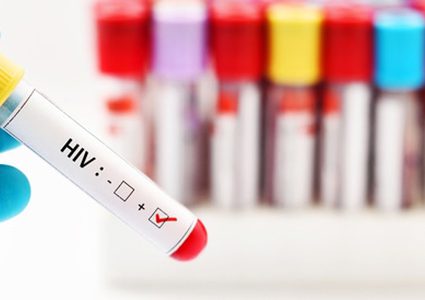 علماء يحرزون تقدما كبيرا في مجال علاج الإيدز