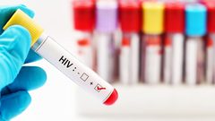 علماء يحرزون تقدما كبيرا في مجال علاج الإيدز