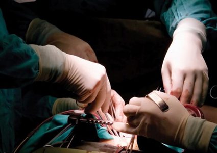 مصر... إلقاء القبض على عصابة تجارة الكُلى