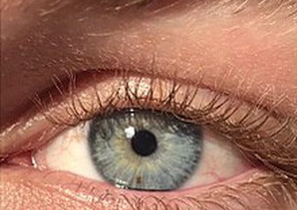 علماء: كورونا يصيب قرنية العين بعد الوفاة