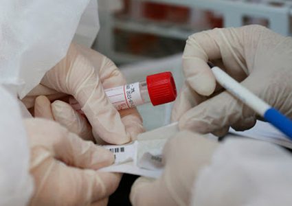 26 حالة وفاة و1363 إصابة جديدة بكورونا خلال 24 ساعة