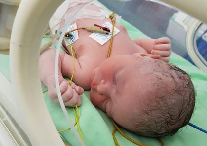 صحة غزة: نفاد الفحص المخبري P.K.U الخاص بالأطفال حديثي الولادة