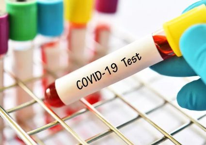 تحذير.. سلالات كورونا المتحورة تخدع اختبارات العدوى