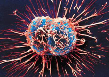 دراسة:  الخلايا السرطانية قادرة على السبات