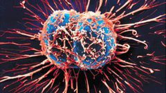 دراسة:  الخلايا السرطانية قادرة على السبات