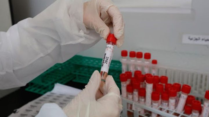 6 حالات وفاة و317 إصابة جديدة بكورونا في غزة