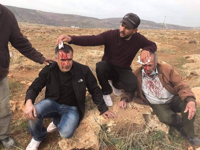 إصابة مواطنين جراء اعتداء المستوطنين على مزارعين شرق نابلس