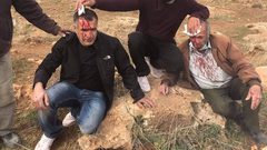 إصابة مواطنين جراء اعتداء المستوطنين على مزارعين شرق نابلس