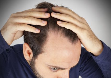 هرمون الصلع و أهم وظائفه للرجال