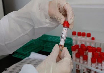 4 حالات وفاة و284 إصابة جديدة بـ"كورونا" في غزة