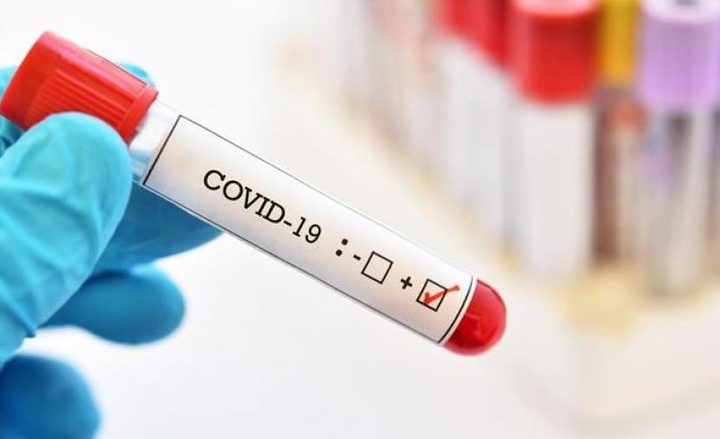 10 وفيات و497 إصابة جديدة بكورونا خلال 24 ساعة