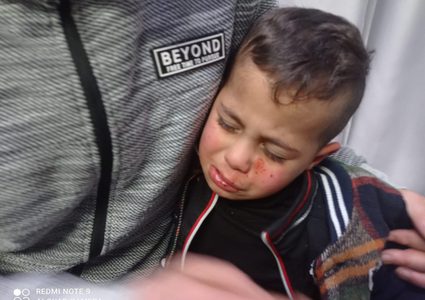 رام الله: مستوطنون يصيبون طفلا جروح على مدخل قرية برقة