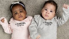 بريطانية تضع توأما مختلطي العرق