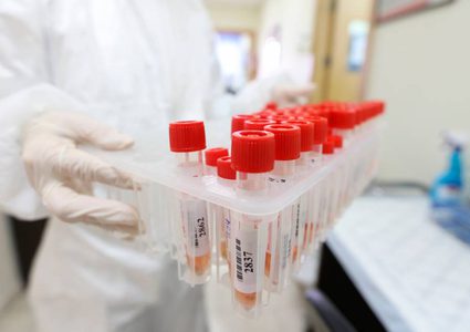 3 وفيات و470 إصابة جديدة بفيروس كورونا خلال 24 ساعة