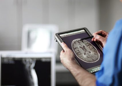 علماء يكتشفون سمة مميزة في أدمغة المصابين بالإكتئاب