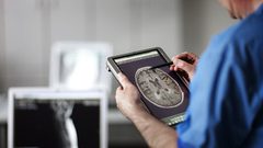 علماء يكتشفون سمة مميزة في أدمغة المصابين بالإكتئاب