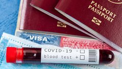 ما هي اختبارات "كوفيد-19" المطلوبة للسفر ؟