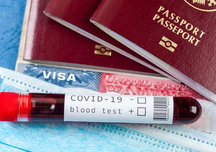 ما هي اختبارات "كوفيد-19" المطلوبة للسفر ؟