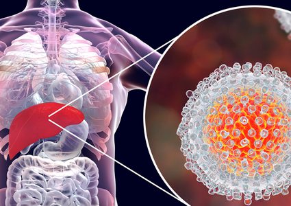 أهم علامات الإصابة بمرض الكبد الدهني