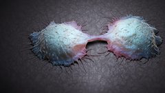 تطوير علاج خاص للأشخاص المصابين بسرطان الدماغ