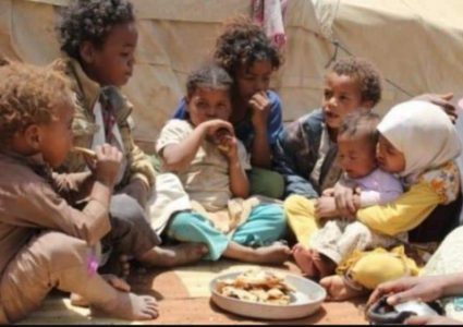 الأمم المتحدة: نصف أطفال اليمن سيعانون من سوء التغذية عام 2021