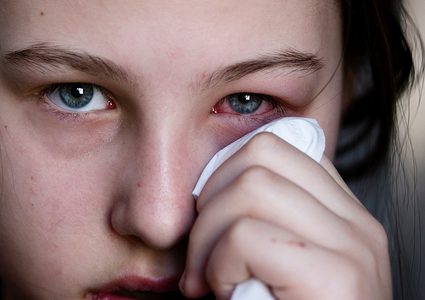 ما هي أسباب الشعور بحرقان العين ؟