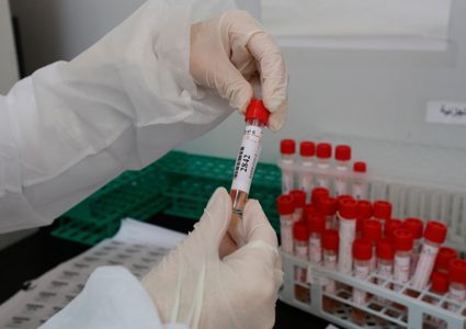 الصحة: تسجيل 139 إصابة بالطفرة البريطانية في الضفة