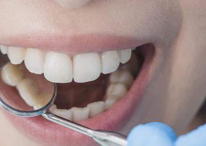 ماذا يحدث لأسنانك إذا لم تعالج التسوس؟