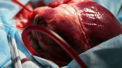 دراسة بريطانية تكشف التأثير الخطير لكورونا على صحة القلب