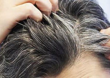 تعرف على أسباب تغير لون الشعر