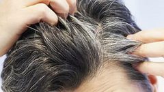 تعرف على أسباب تغير لون الشعر