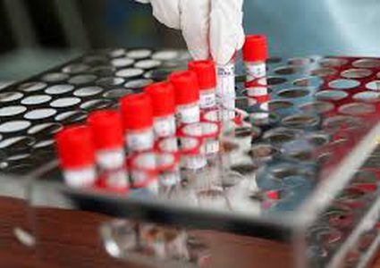 مصر تسجل 623 إصابة و51 وفاة جديدة بكورونا