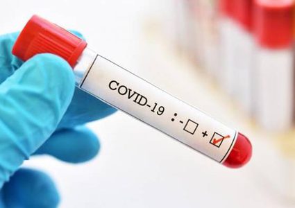 23 وفاة و1911 اصابة بكورونا خلال 24 ساعة