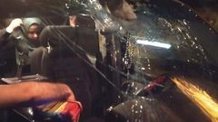 اصابة شاب من بلدة ديرستيا جراء دهسه من قبل مستوطن