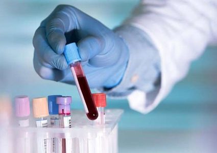 دراسة: فصيلة دم "A" تعرض أصحابها لخطر كورونا