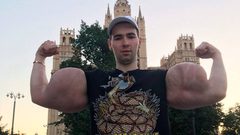 بوباي روسيا يواجه خطر فقد ذراعيه ويشعر بـ"الغباء الشديد" !