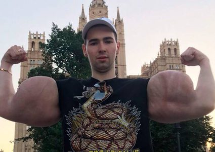 بوباي روسيا يواجه خطر فقد ذراعيه ويشعر بـ"الغباء الشديد" !