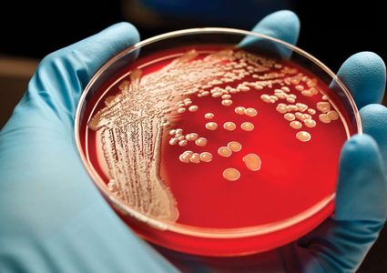 ما خطورة إصابة مرضى سرطان الدم بفيروس كورونا؟