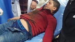 إصابة طفل بانفجار قنبلة من مخلفات الاحتلال في طوباس