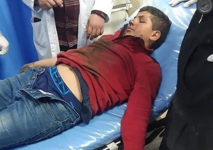 إصابة طفل بانفجار قنبلة من مخلفات الاحتلال في طوباس