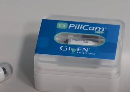 وداعا للتنظير.. كاميرا قابلة للبلع لرصد سرطان القولون