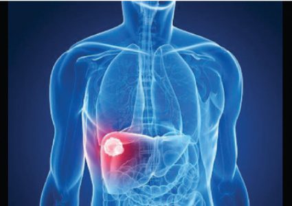 إذا شعرت بهذا في الليل.. فأنت بحاجة إلى فحص الكبد