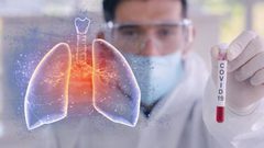 طبيب روسي يتحدث عن متلازمة ما بعد "كورونا"